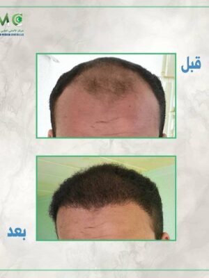 imageye___-_imgi_112_143354096_418476762712772_3944282991661683458_n