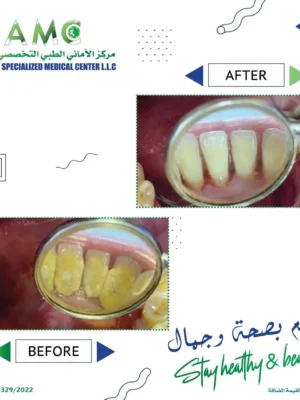 imageye___-_imgi_20_311324185_125544103613116_7101946396957542347_n