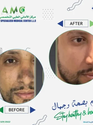 imageye___-_imgi_28_286995638_155337790351420_6024874857774159425_n