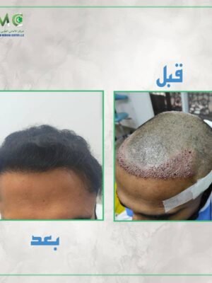 imageye___-_imgi_58_245206356_1037712627012216_7543941212051855062_n